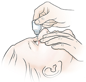 Mujer que inclina la cabeza hacia atrás y baja suavemente el párpado inferior. Con la otra mano, sostiene un frasco de gotas oculares por encima del ojo. 