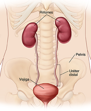 Contorno de una persona donde se observan los riñones, los uréteres, la vejiga y la pelvis.